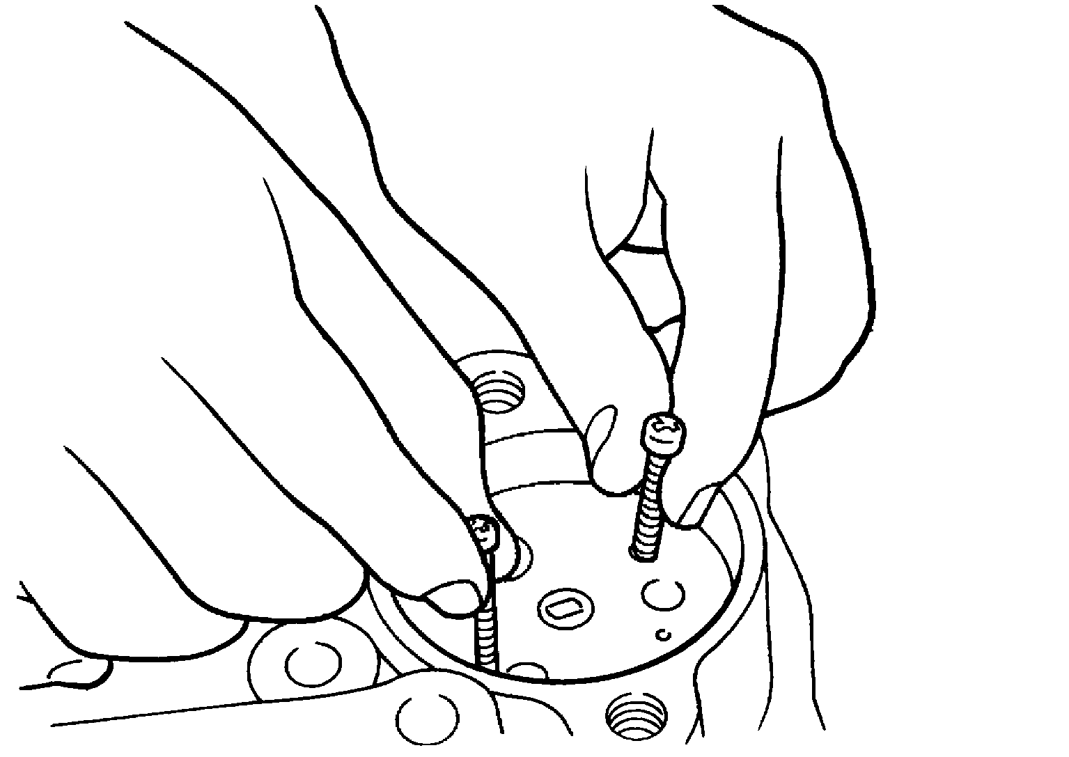 G04134172