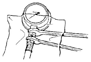 G04807585