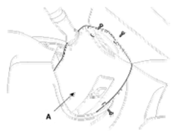 G06525161