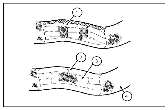 G09128676